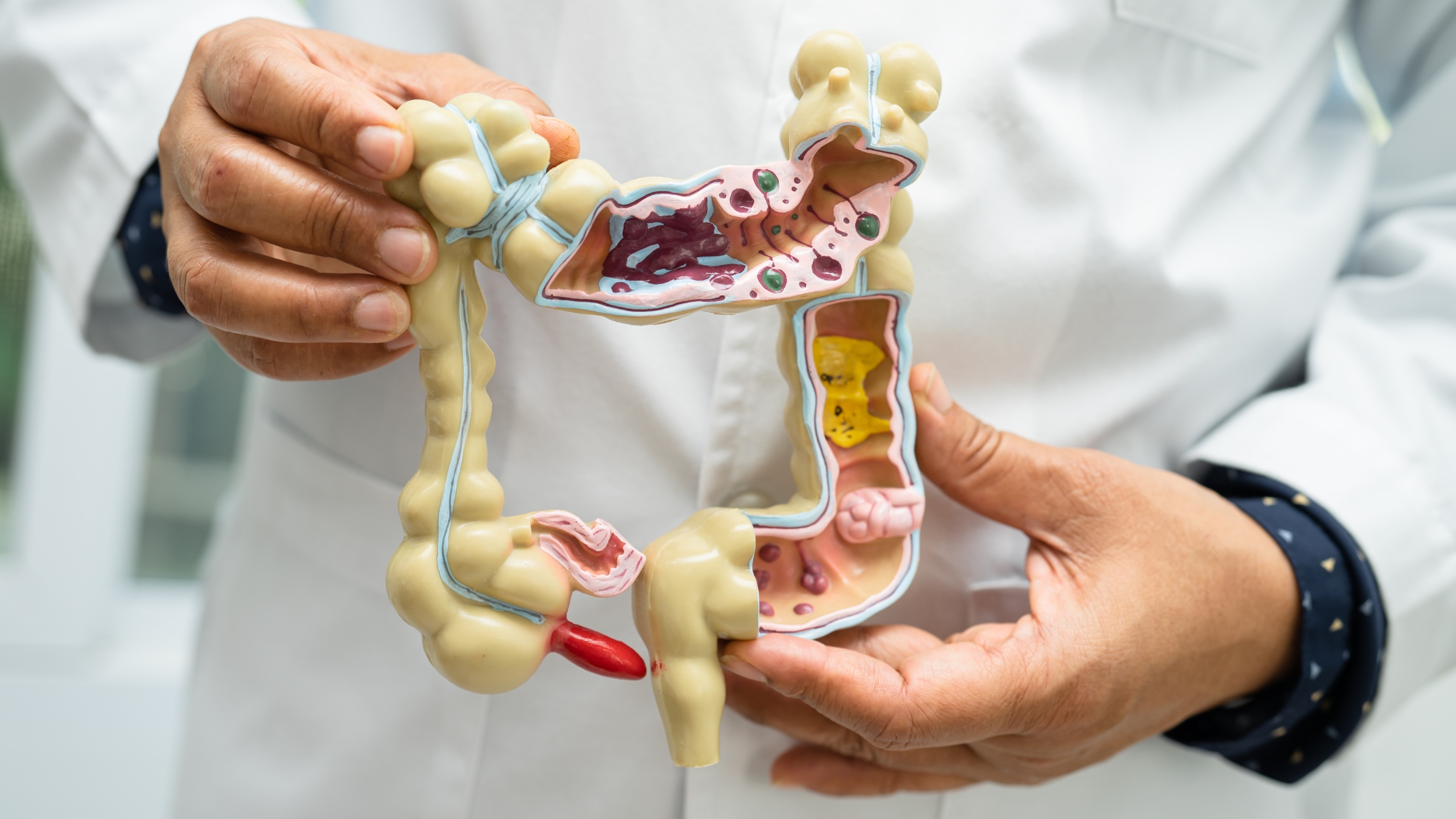 A model of the gut highlighting intestinal health