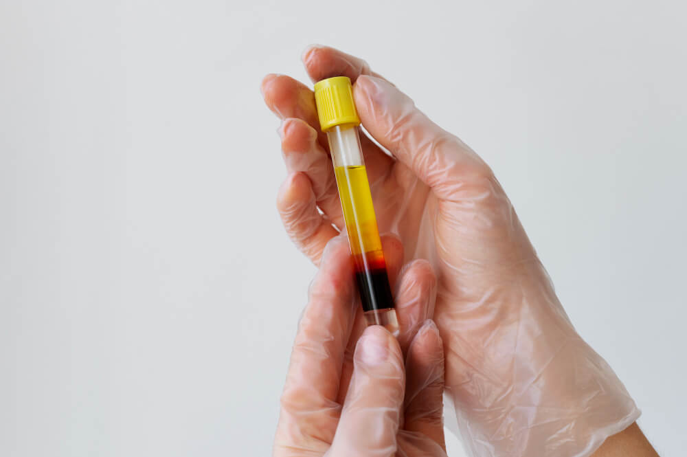 Hands holding vial chloride test close up